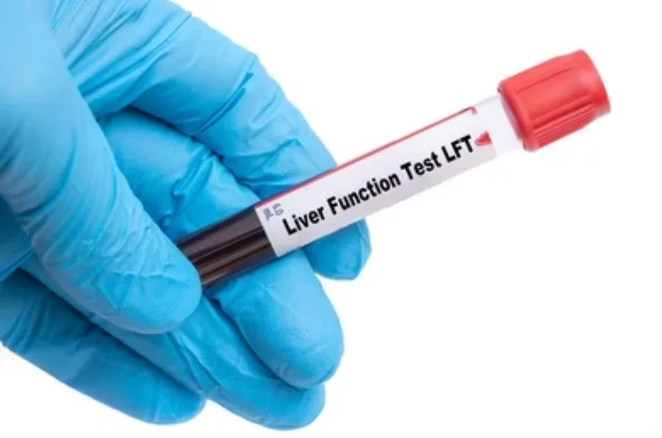 Liver function test