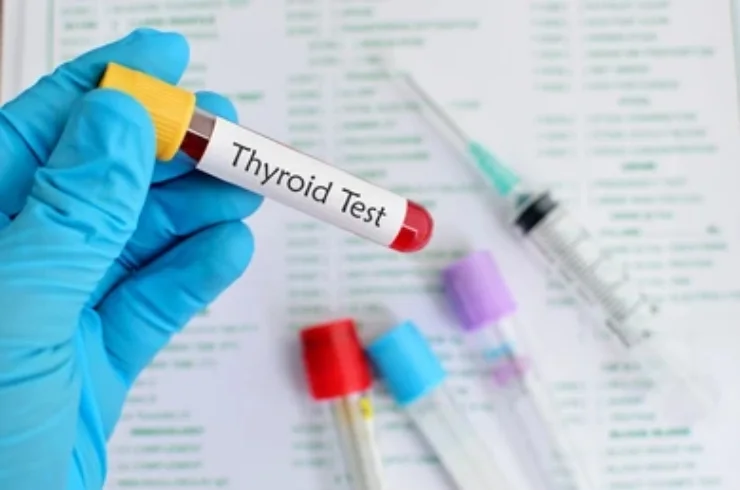 Thyroid profile Test------01